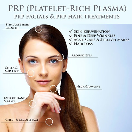 prp treatments